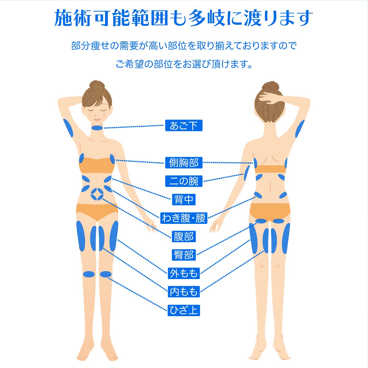 施術可能部位